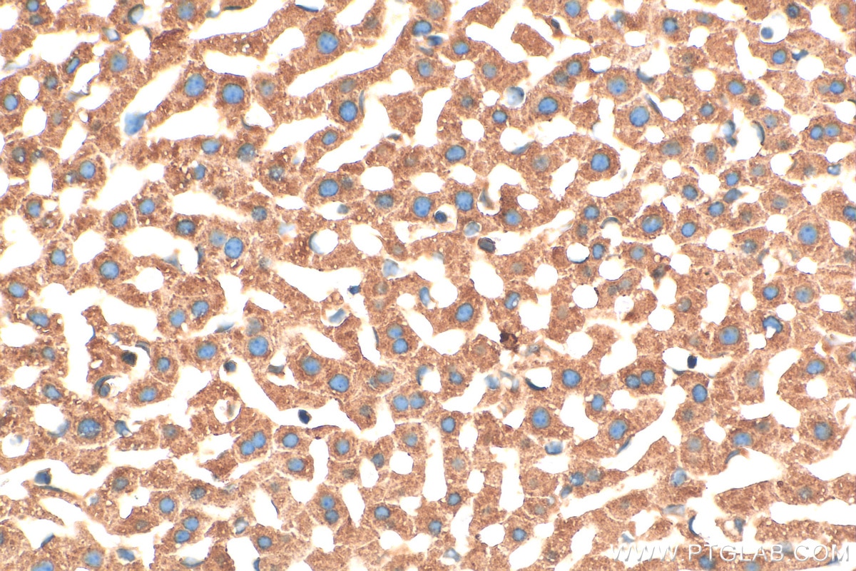Immunohistochemistry (IHC) staining of mouse liver tissue using Prokineticin 1 Polyclonal antibody (15152-1-AP)