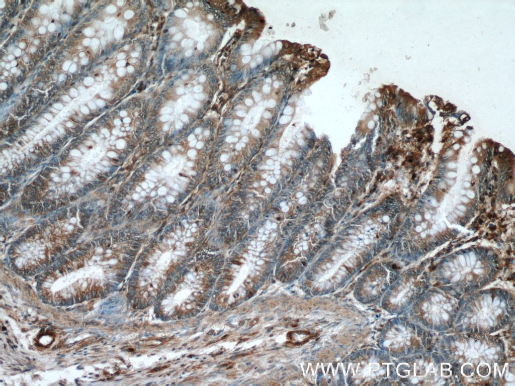 Immunohistochemistry (IHC) staining of human colon tissue using Prokineticin 2 Polyclonal antibody (24906-1-AP)