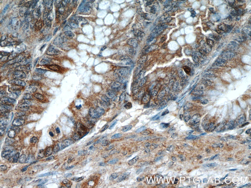 Immunohistochemistry (IHC) staining of human colon tissue using Prokineticin 2 Polyclonal antibody (24906-1-AP)