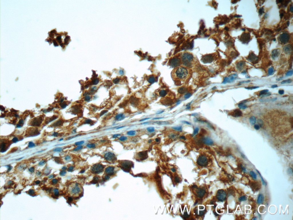 Immunohistochemistry (IHC) staining of human testis tissue using Prokineticin 2 Polyclonal antibody (24906-1-AP)