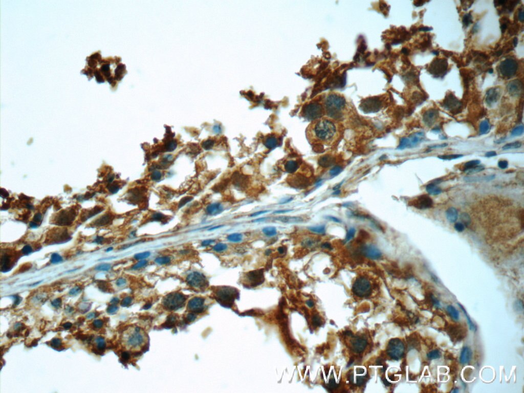 IHC staining of human testis using 24906-1-AP