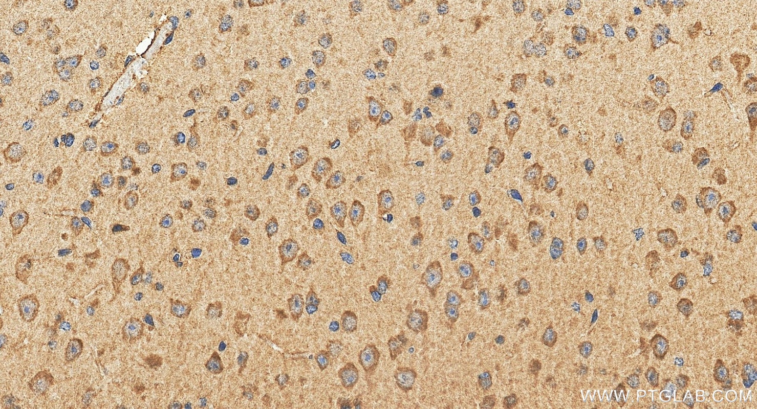 IHC staining of mouse brain using 24906-1-AP Immunohistochemistry (IHC) staining of mouse brain tissue using Prokineticin 2 Polyclonal antibody (24906-1-AP)