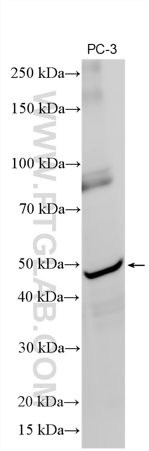 WB analysis using 21367-1-AP (same clone as 21367-1-PBS) Western Blot (WB) analysis of various lysates using PROKR1 Polyclonal antibody (21367-1-AP)