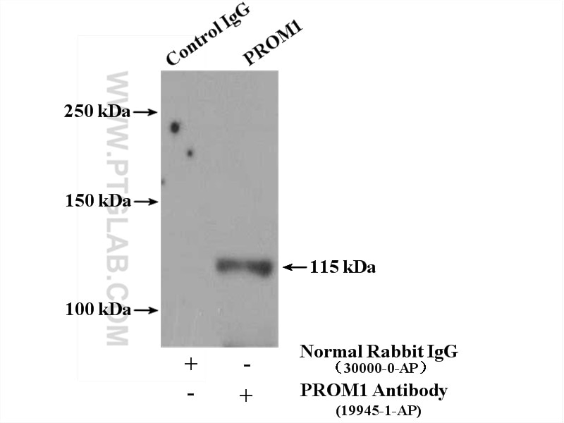Immunoprecipitation (IP) experiment of Y79 cells using CD133-1,2,4,7 Polyclonal antibody (19945-1-AP)