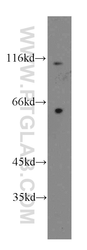 Western Blot (WB) analysis of mouse lung tissue using CD133-1,2,4,7 Polyclonal antibody (19945-1-AP)