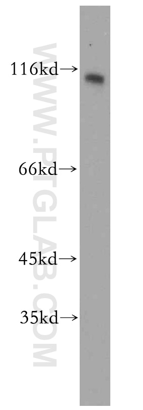 Western Blot (WB) analysis of Y79 cells using CD133-1,2,4,7 Polyclonal antibody (19945-1-AP)