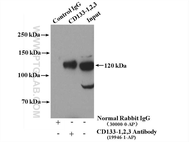 Immunoprecipitation (IP) experiment of Y79 cells using CD133-1,2 Polyclonal antibody (19946-1-AP)