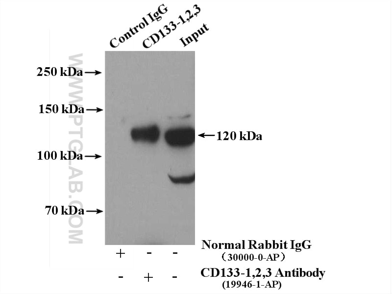 IP experiment of Y79 using 19946-1-AP