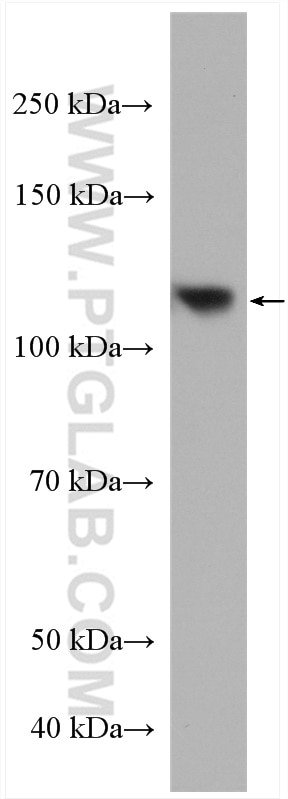 Western Blot (WB) analysis of HT-29 cells using CD133-1,2 Polyclonal antibody (19946-1-AP)