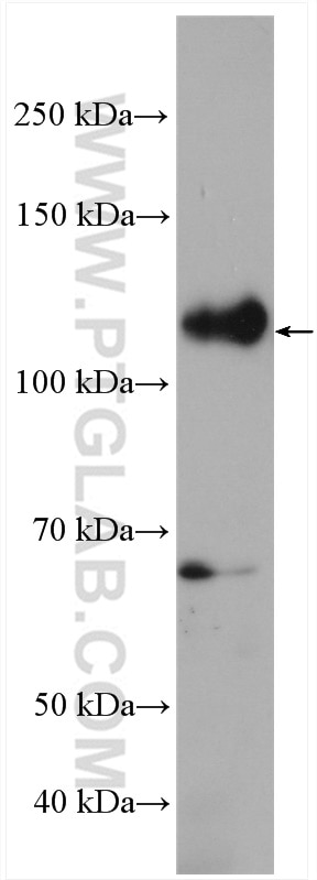 Western Blot (WB) analysis of Caco-2 cells using CD133-1,2 Polyclonal antibody (19946-1-AP)