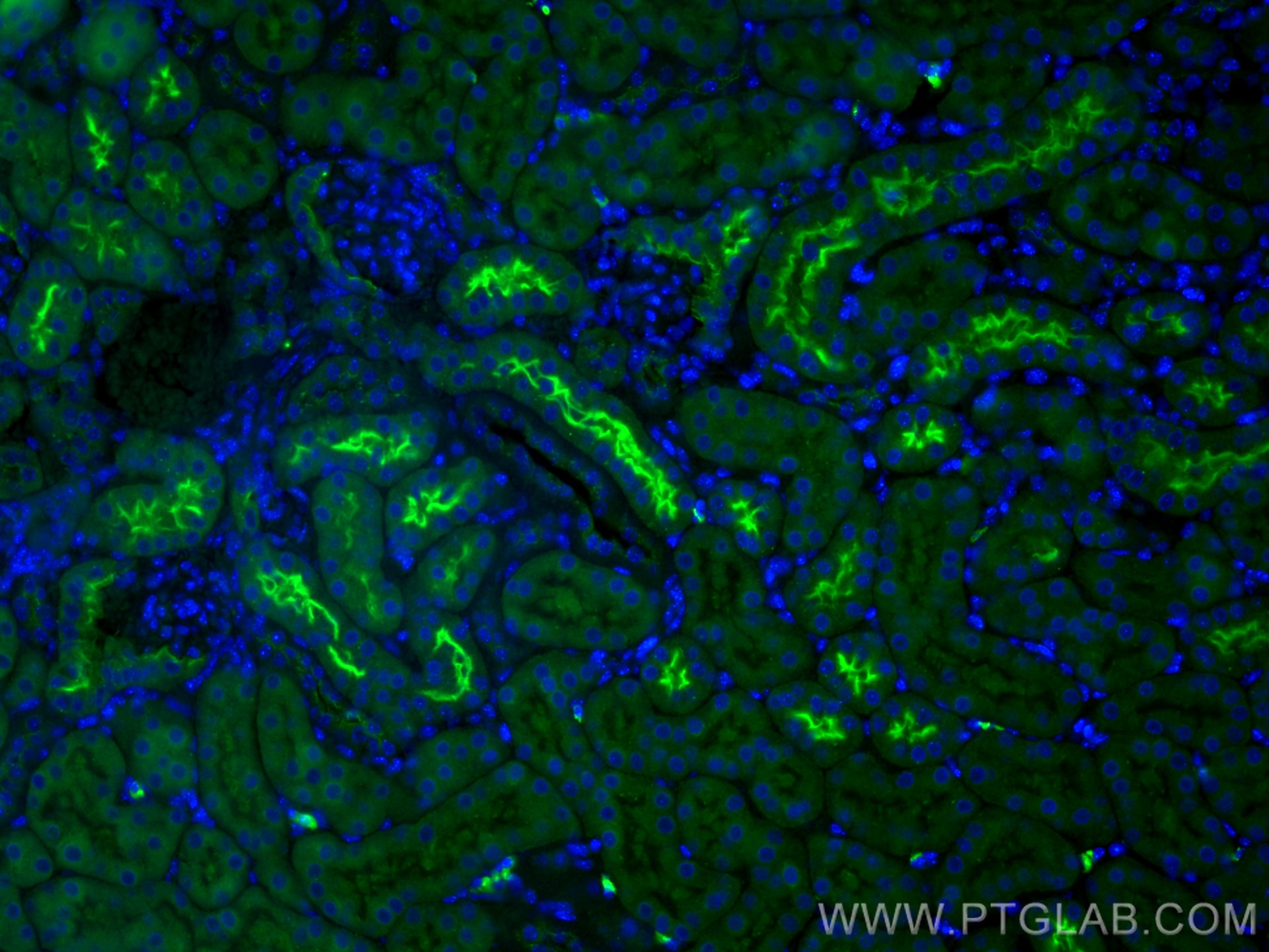 IF Staining of mouse kidney using 18470-1-AP