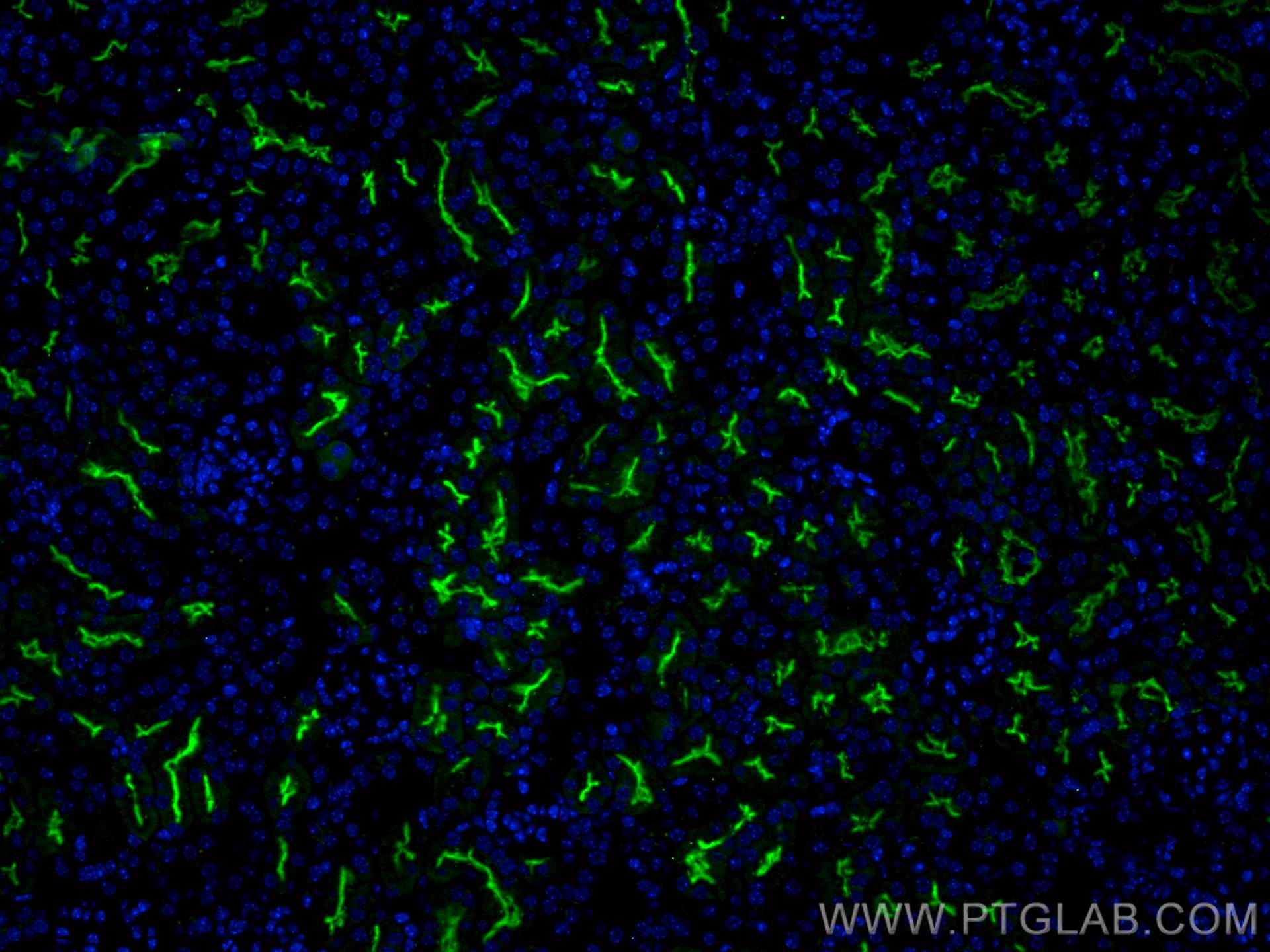 Immunofluorescence (IF) / fluorescent staining of mouse kidney tissue using CD133 Polyclonal antibody (18470-1-AP)