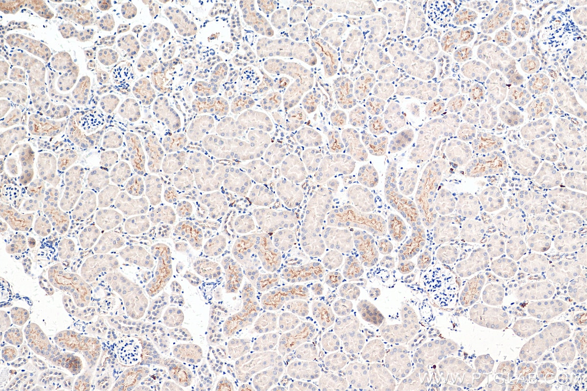Immunohistochemistry (IHC) staining of mouse kidney tissue using CD133 Polyclonal antibody (18470-1-AP)