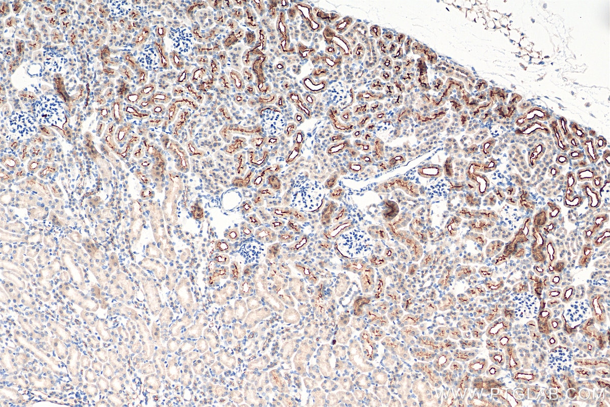 Immunohistochemistry (IHC) staining of mouse kidney tissue using CD133 Polyclonal antibody (18470-1-AP)