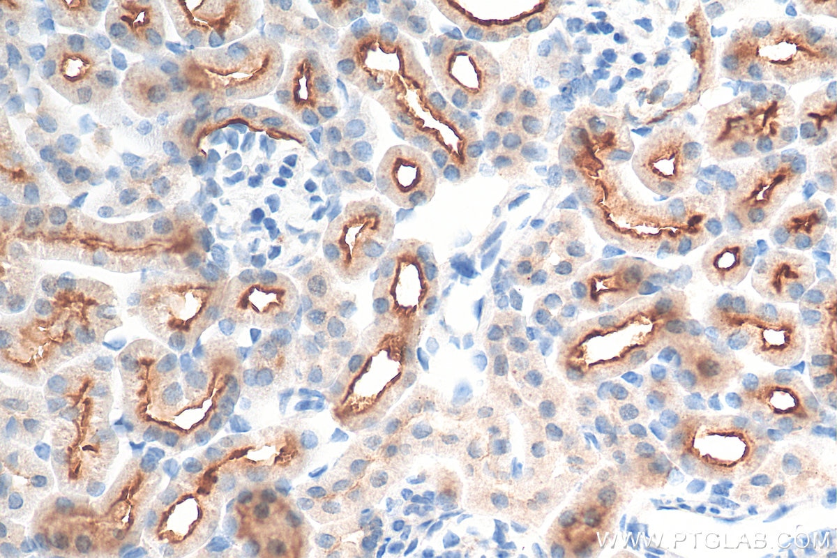 Immunohistochemistry (IHC) staining of mouse kidney tissue using CD133 Polyclonal antibody (18470-1-AP)