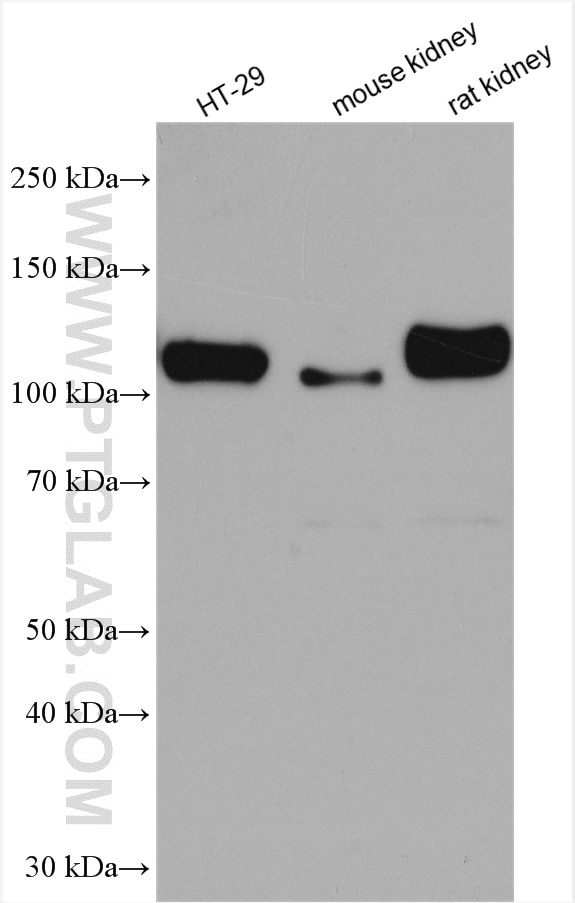 Western Blot (WB) analysis of various lysates using CD133 Polyclonal antibody (18470-1-AP)