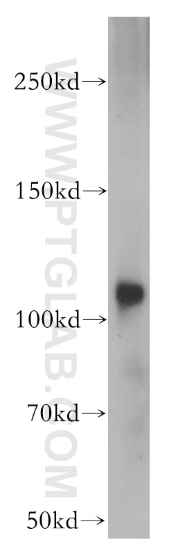 Western Blot (WB) analysis of mouse kidney tissue using CD133 Polyclonal antibody (18470-1-AP)
