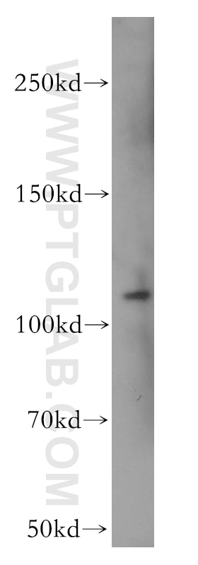 Western Blot (WB) analysis of mouse pancreas tissue using CD133 Polyclonal antibody (18470-1-AP)
