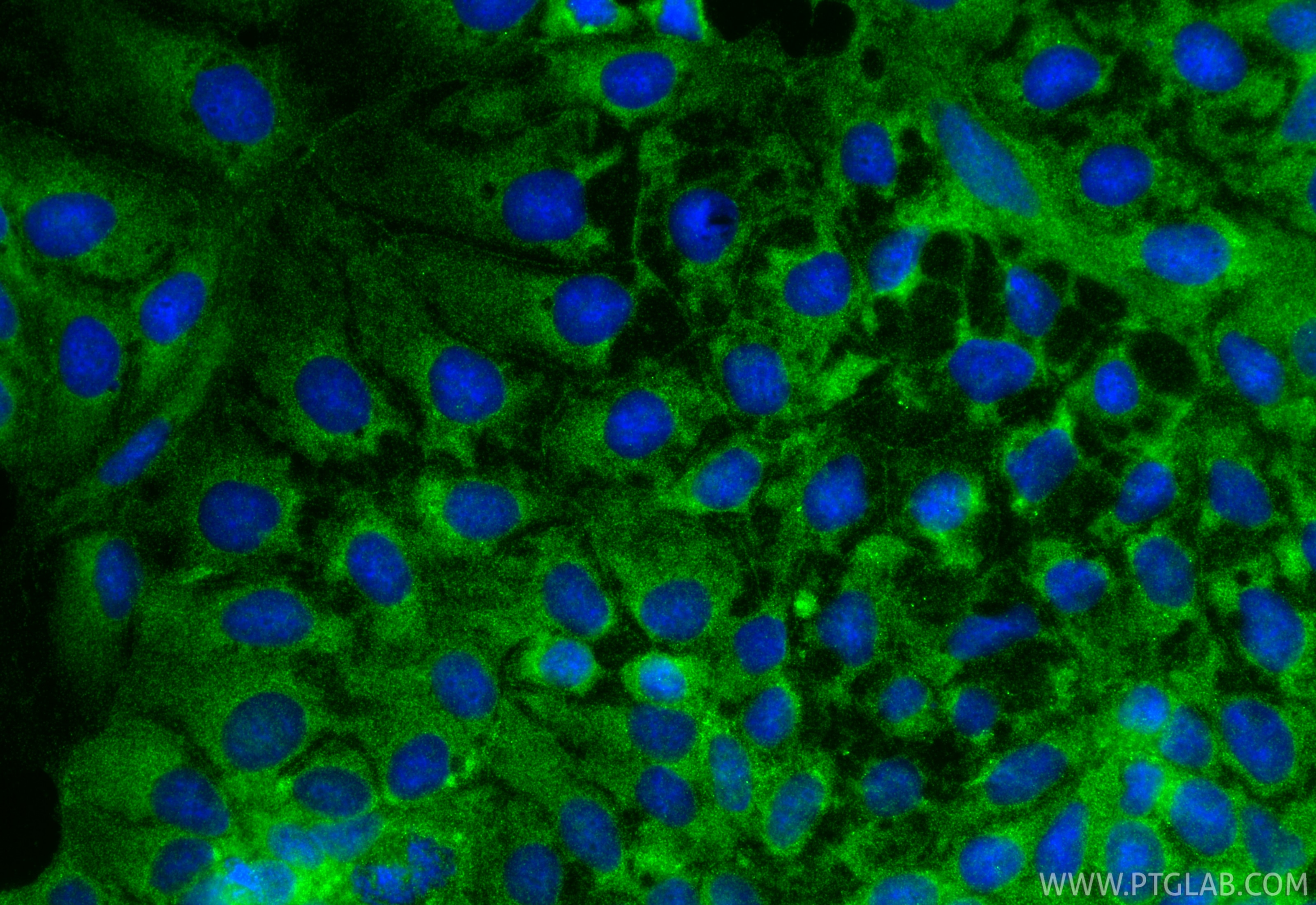 IF Staining of Caco-2 using 18495-1-AP Immunofluorescence (IF) / fluorescent staining of Caco-2 cells using CD133 Polyclonal antibody (18495-1-AP)