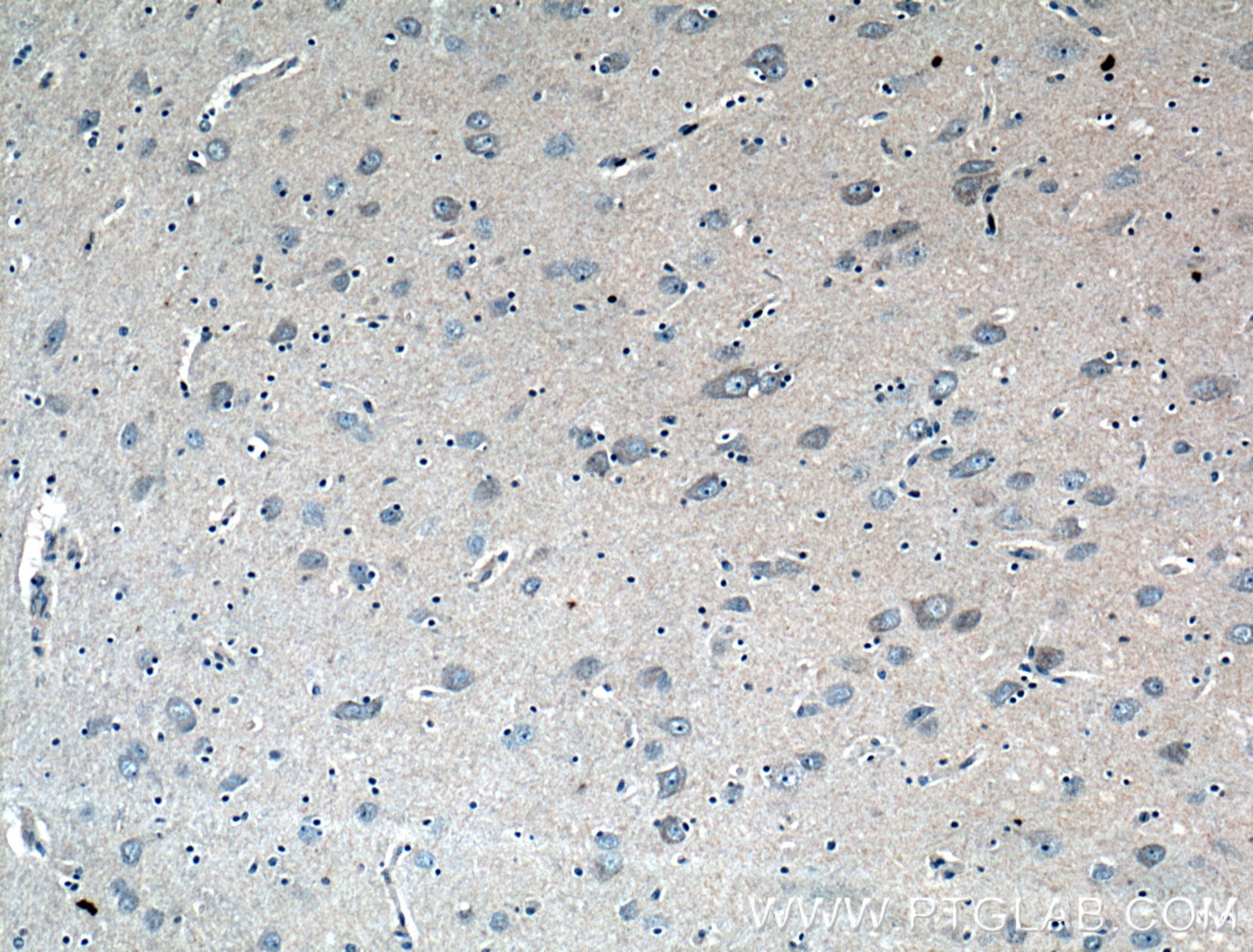 Immunohistochemistry (IHC) staining of human brain tissue using CD133 Polyclonal antibody (18495-1-AP)