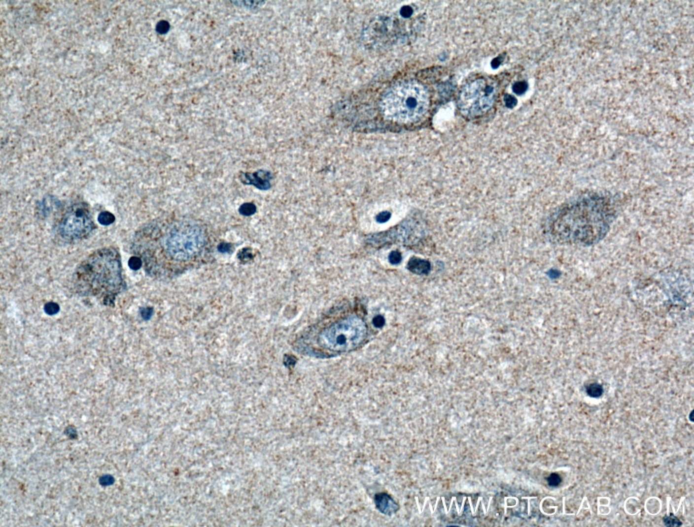 Immunohistochemistry (IHC) staining of human brain tissue using CD133 Polyclonal antibody (18495-1-AP)
