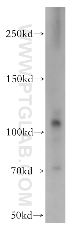 Western Blot (WB) analysis of mouse skeletal muscle tissue using CD133 Polyclonal antibody (18495-1-AP)