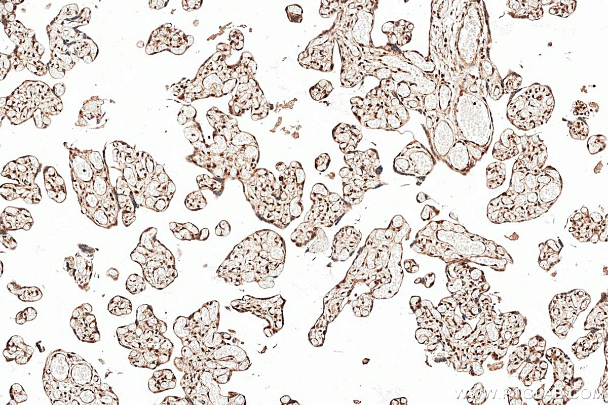 Immunohistochemistry (IHC) staining of human placenta tissue using PROP1 Polyclonal antibody (18739-1-AP)