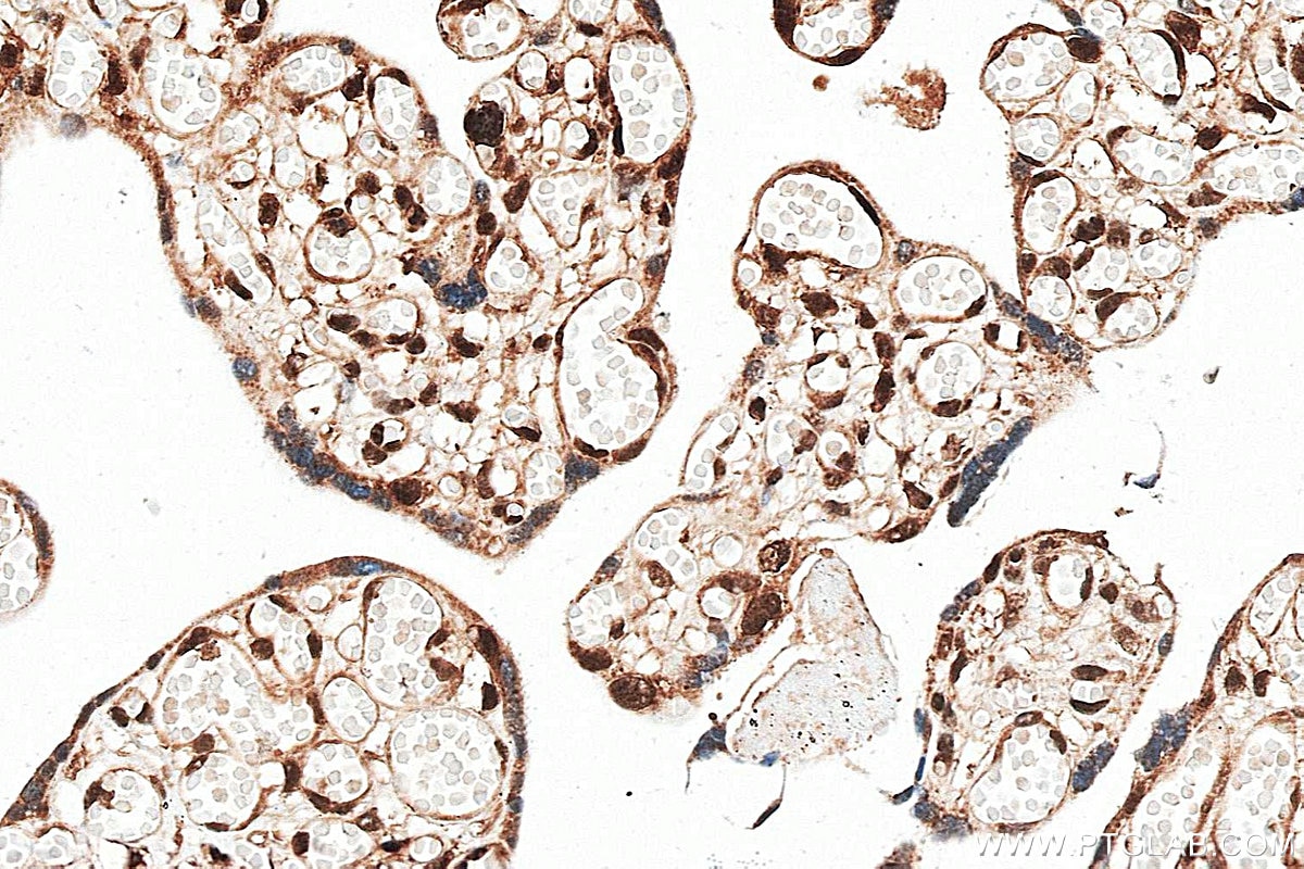 Immunohistochemistry (IHC) staining of human placenta tissue using PROP1 Polyclonal antibody (18739-1-AP)