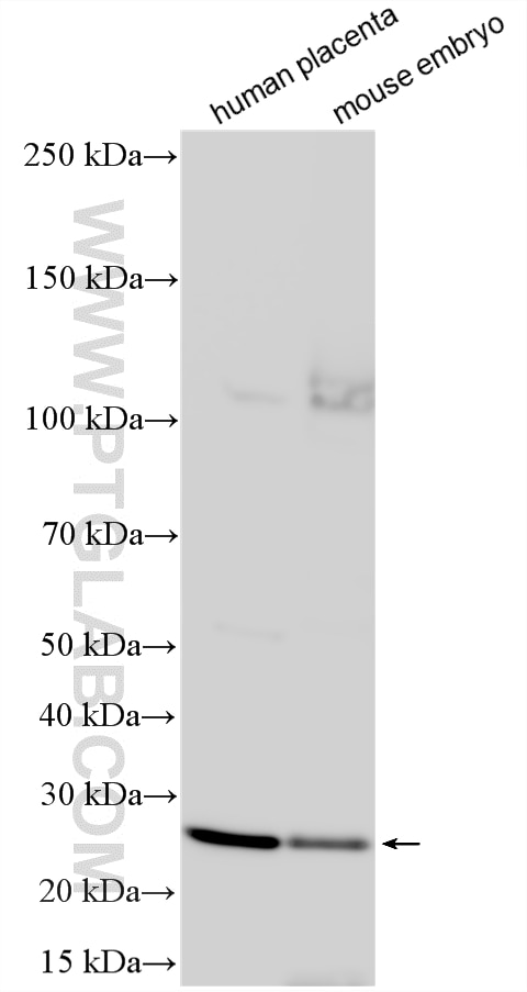 Western Blot (WB) analysis of various lysates using PROP1 Polyclonal antibody (18739-1-AP)