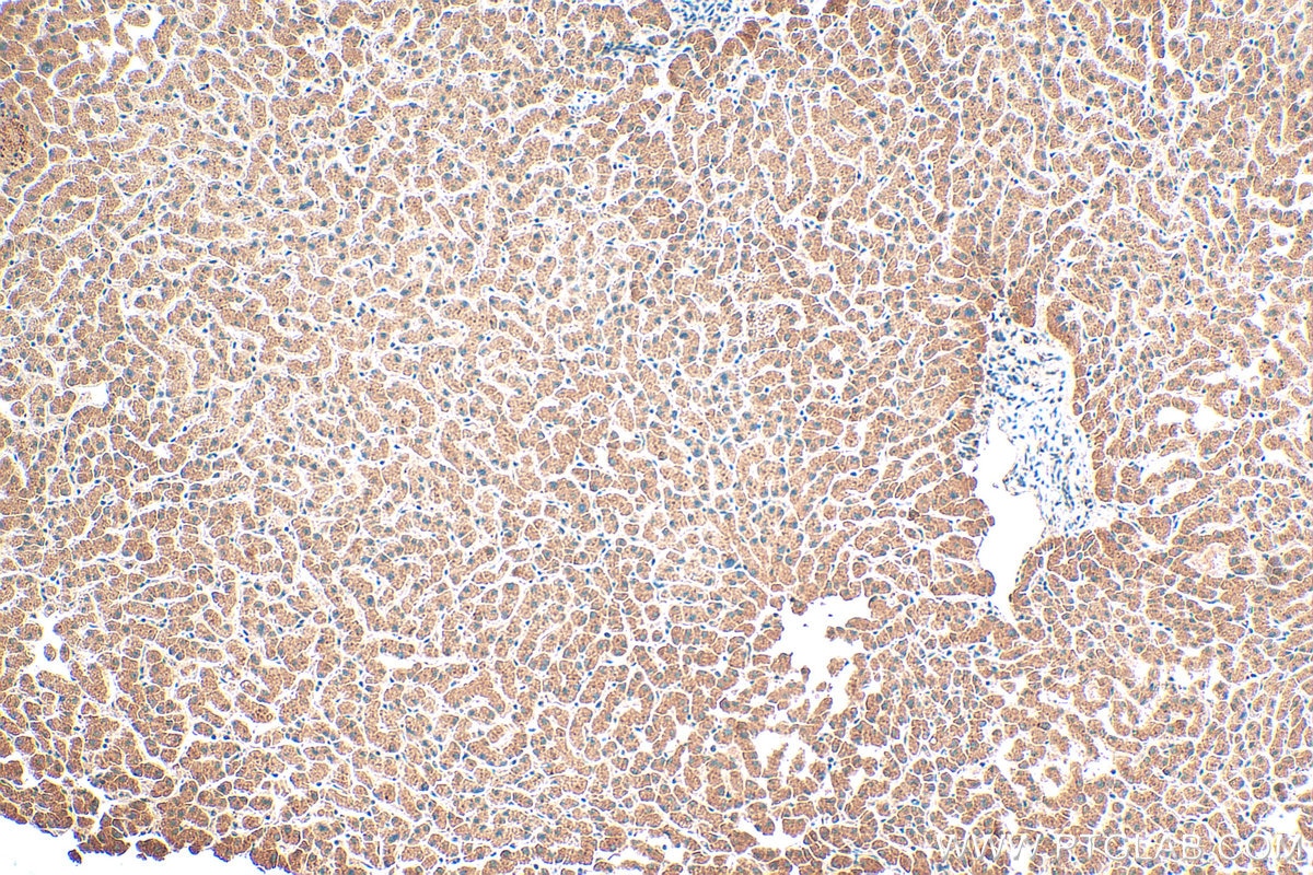 Immunohistochemistry (IHC) staining of human liver tissue using PROS1 Polyclonal antibody (16910-1-AP)