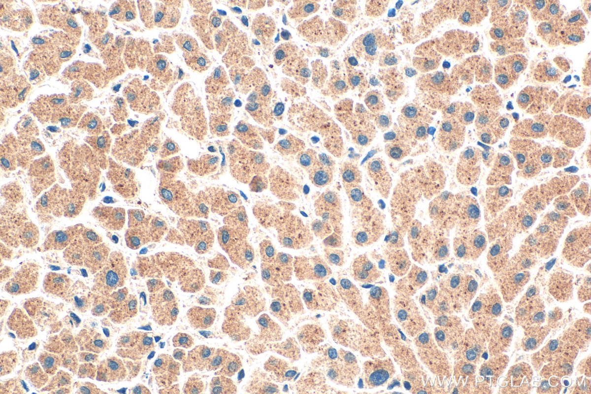 Immunohistochemistry (IHC) staining of human liver tissue using PROS1 Polyclonal antibody (16910-1-AP)