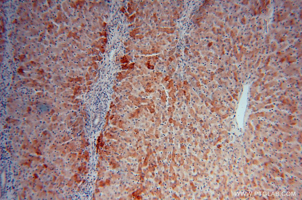 Immunohistochemistry (IHC) staining of human liver tissue using PROS1 Polyclonal antibody (16910-1-AP)