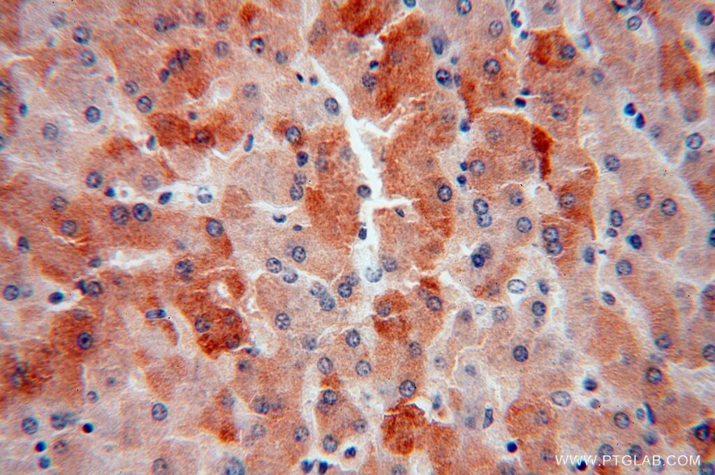 Immunohistochemistry (IHC) staining of human liver tissue using PROS1 Polyclonal antibody (16910-1-AP)