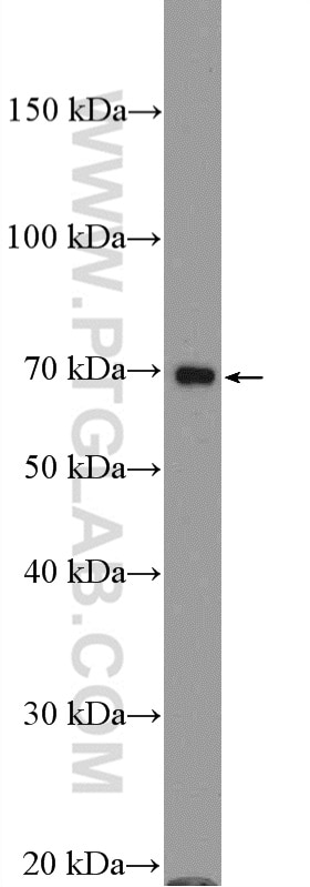Western Blot (WB) analysis of mouse placenta tissue using PROS1 Polyclonal antibody (16910-1-AP)