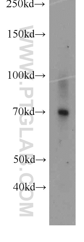 Western Blot (WB) analysis of human placenta tissue using PROS1 Polyclonal antibody (16910-1-AP)