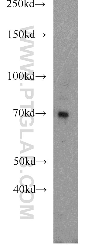 Western Blot (WB) analysis of human placenta tissue using PROS1 Polyclonal antibody (16910-1-AP)