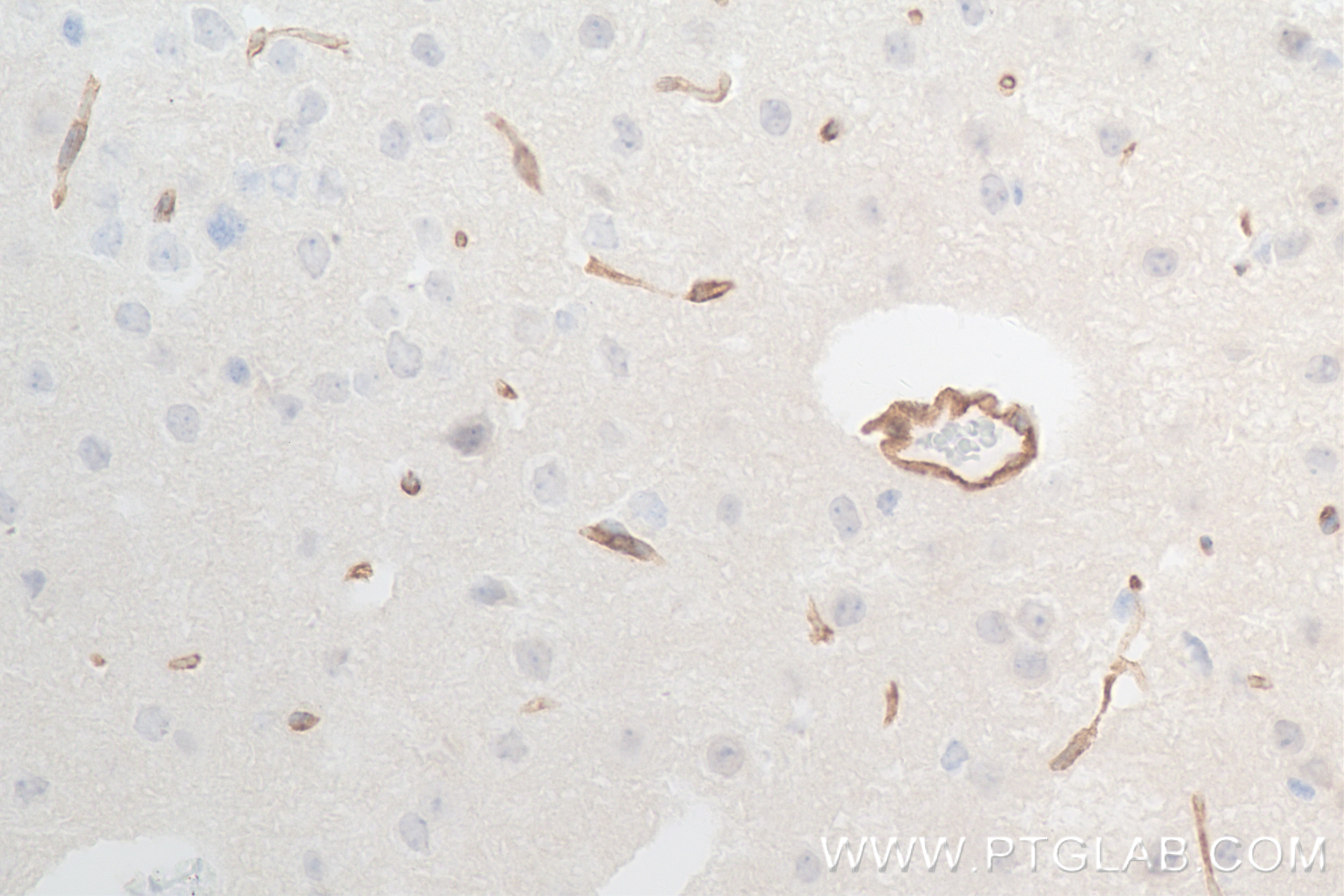 Immunohistochemistry (IHC) staining of mouse brain tissue using PROS1 Recombinant antibody (84107-2-RR)