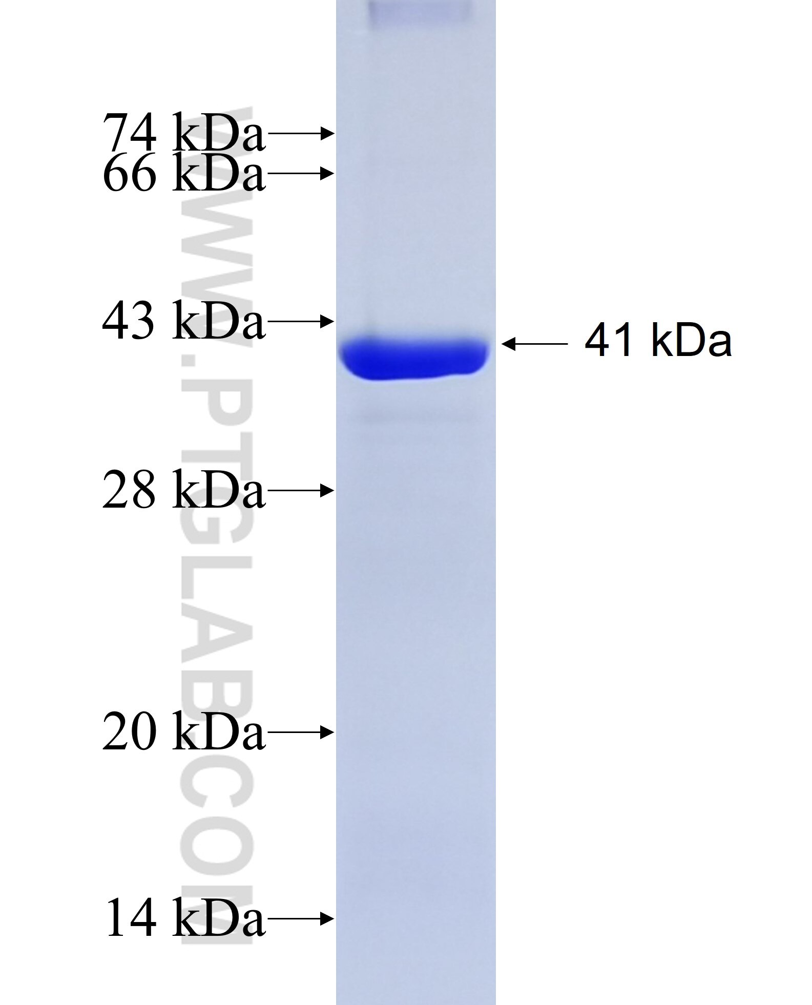 PROS1 fusion protein Ag10503 SDS-PAGE