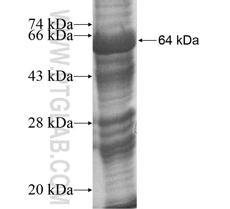 PROS1 fusion protein Ag10539 SDS-PAGE