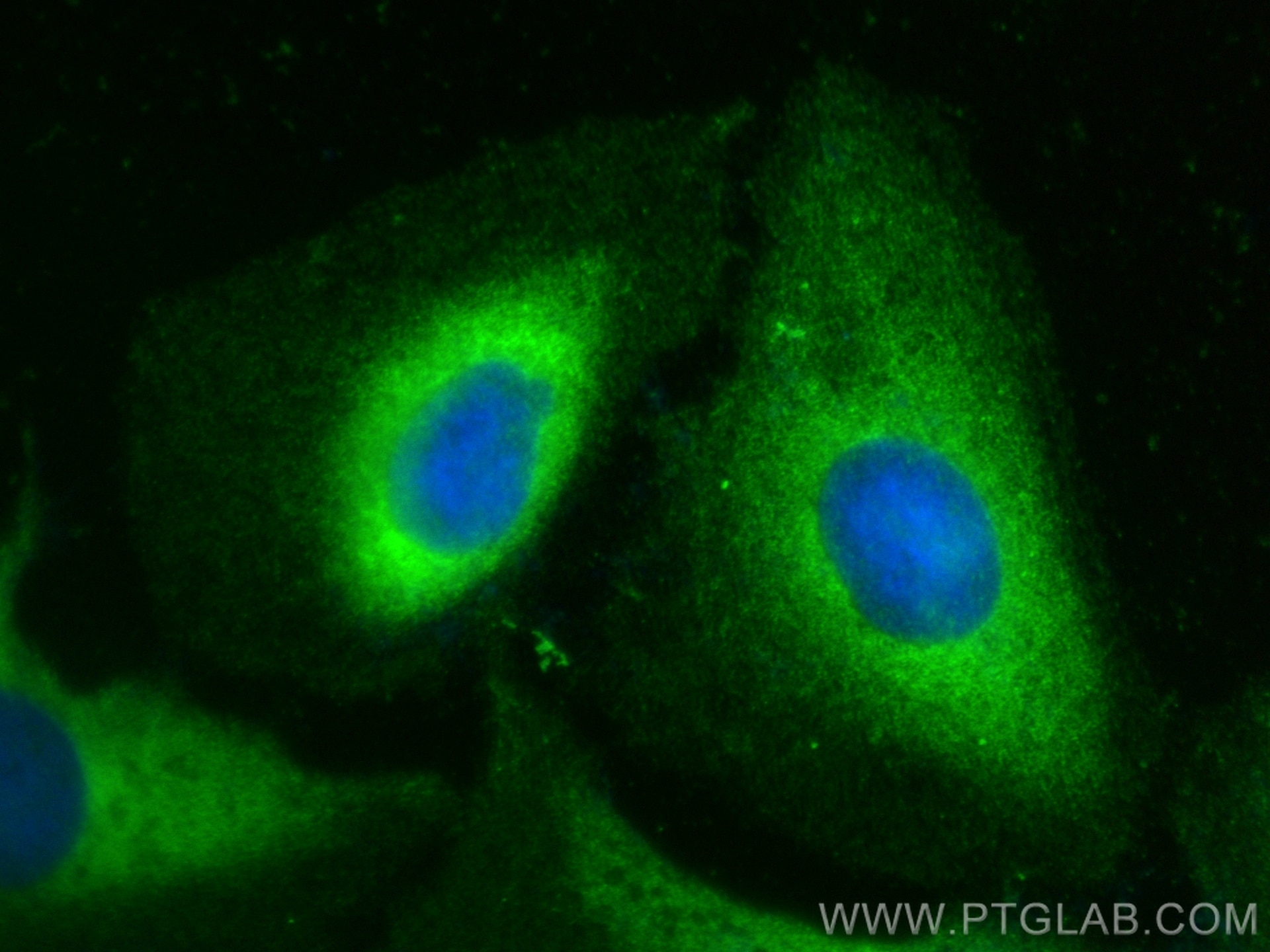 Immunofluorescence (IF) / fluorescent staining of U2OS cells using PROSC Polyclonal antibody (25154-1-AP)