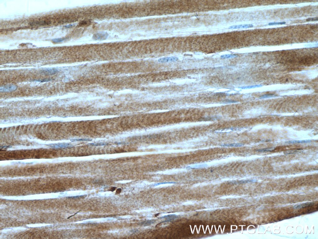 Immunohistochemistry (IHC) staining of human skeletal muscle tissue using PROSC Polyclonal antibody (25154-1-AP)