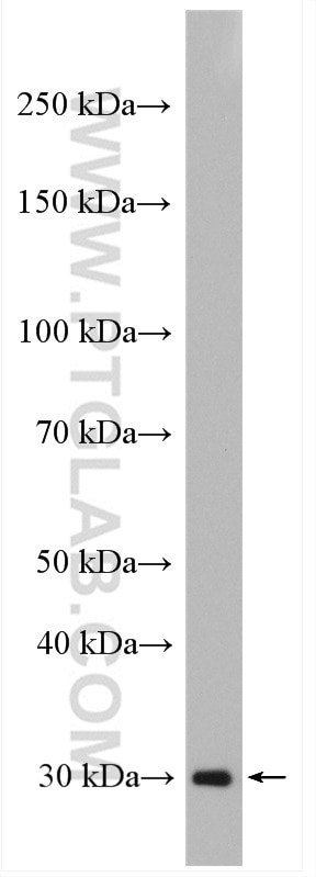 Western Blot (WB) analysis of L02 cells using PROSC Polyclonal antibody (25154-1-AP)