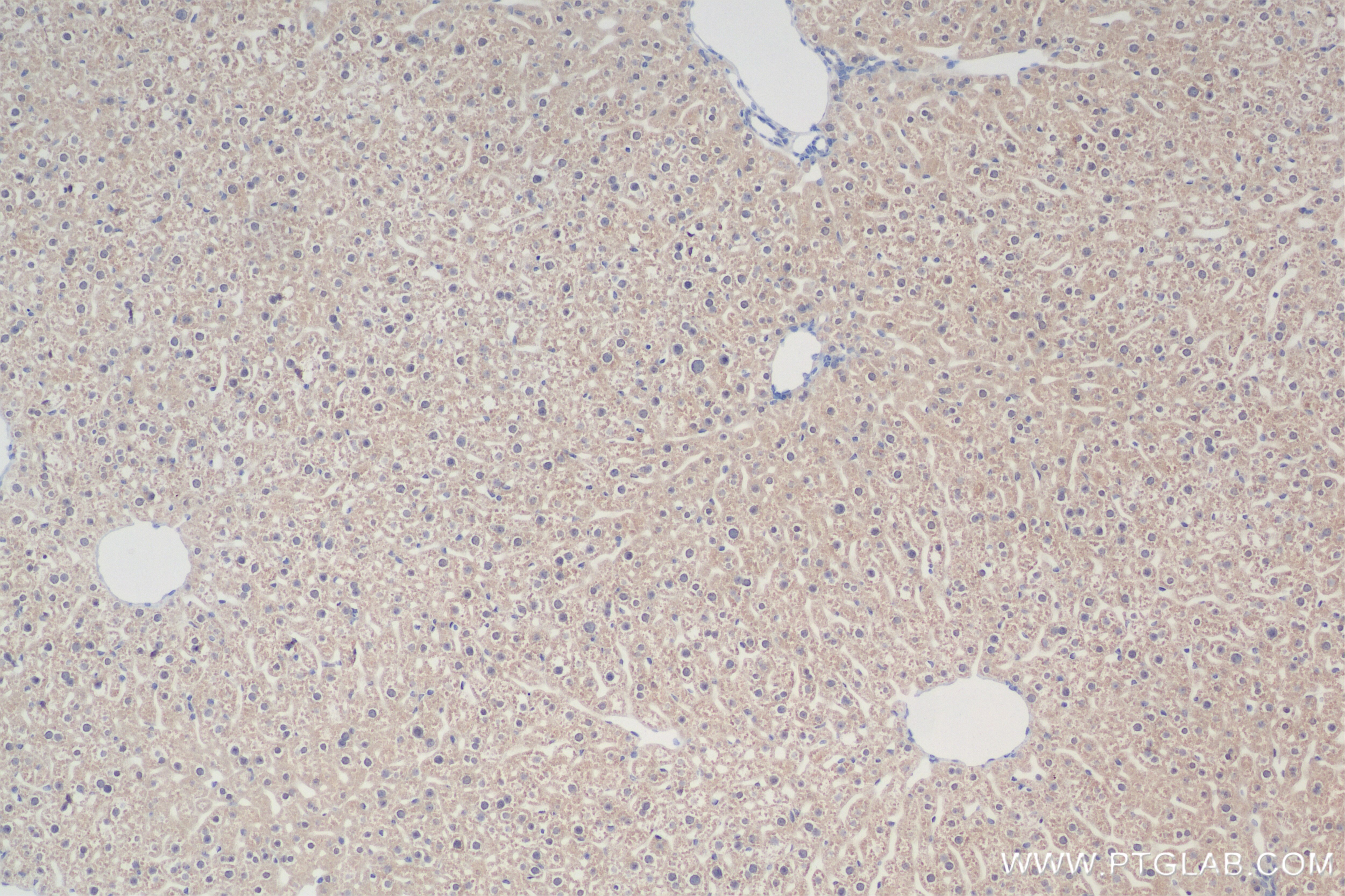 Immunohistochemistry (IHC) staining of mouse liver tissue using PROSC Recombinant antibody (83831-5-RR)