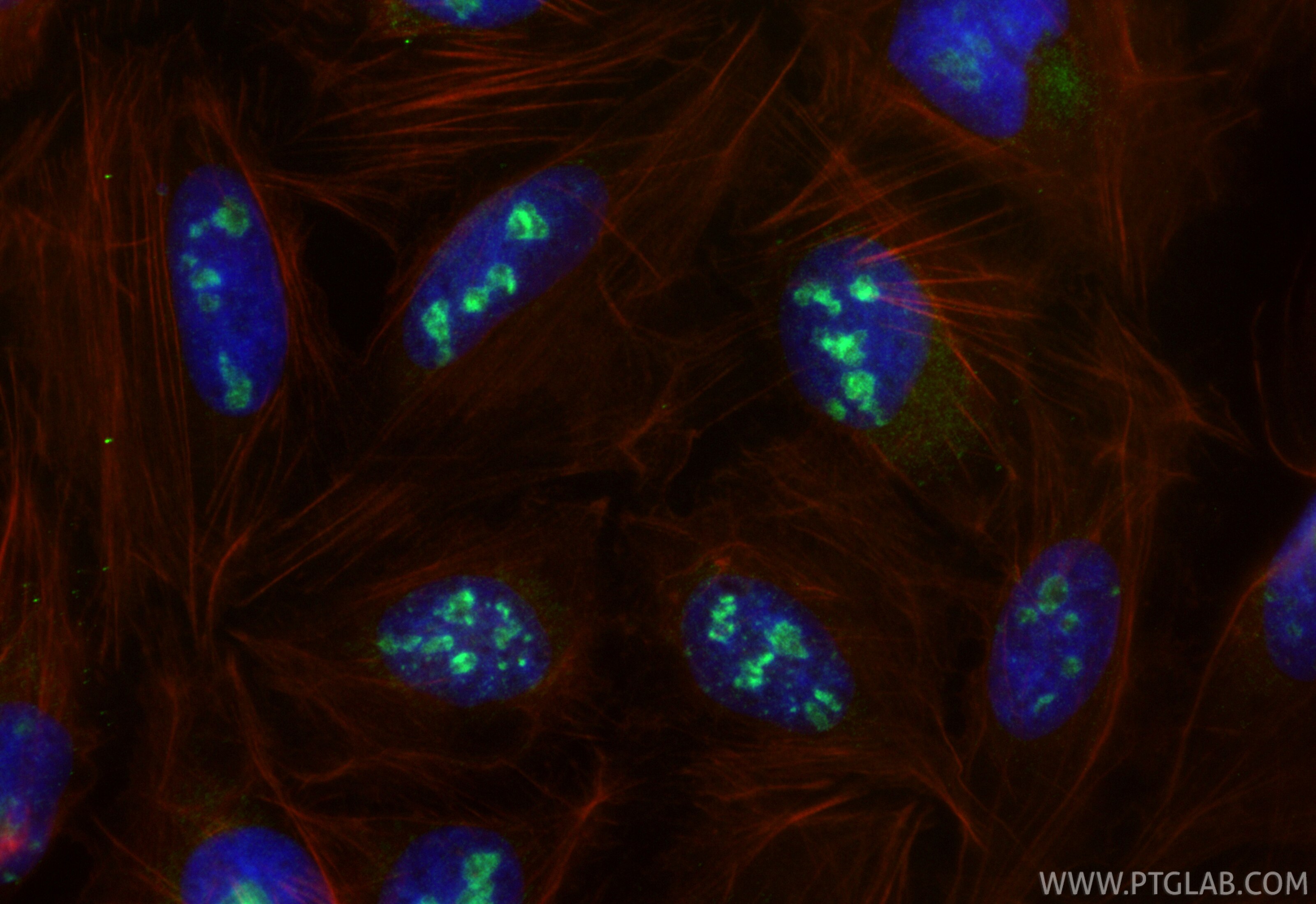 IF Staining of U2OS using 31494-1-AP Immunofluorescence (IF) / fluorescent staining of U2OS cells using PROSER1 Polyclonal antibody (31494-1-AP)