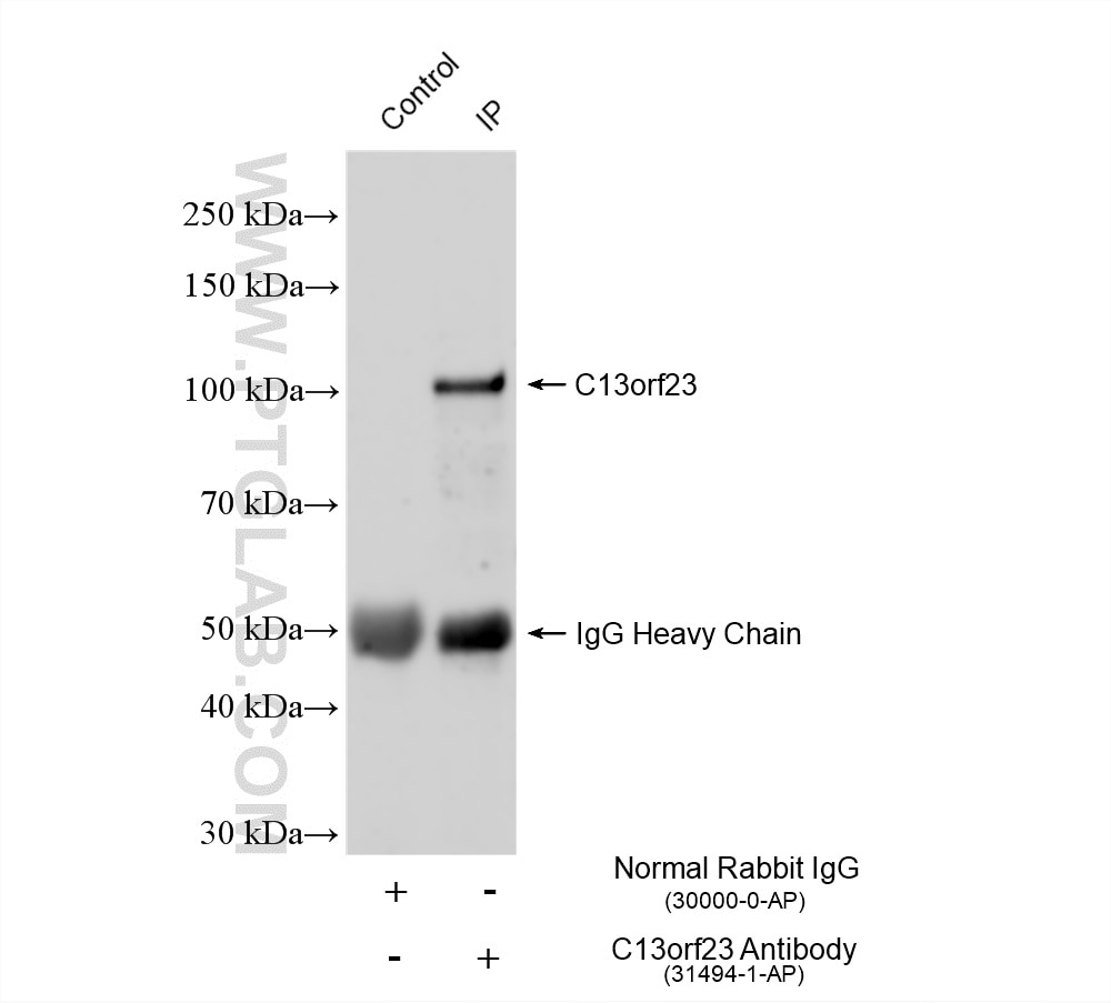IP experiment of Jurkat using 31494-1-AP Immunoprecipitation (IP) experiment of Jurkat cells using PROSER1 Polyclonal antibody (31494-1-AP)