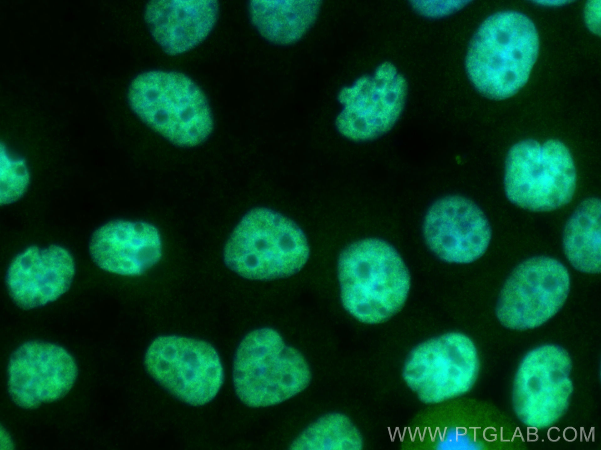 Immunofluorescence (IF) / fluorescent staining of HuH-7 cells using PROX1 Polyclonal antibody (11067-2-AP)
