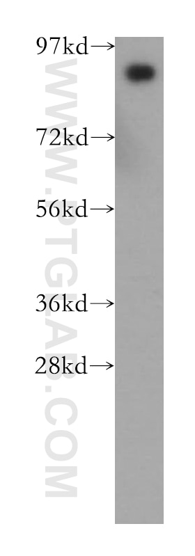 Western Blot (WB) analysis of human liver tissue using PROX1 Polyclonal antibody (11067-2-AP)