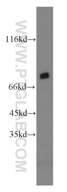 Western Blot (WB) analysis of mouse brain tissue using PROX1 Polyclonal antibody (19554-1-AP)