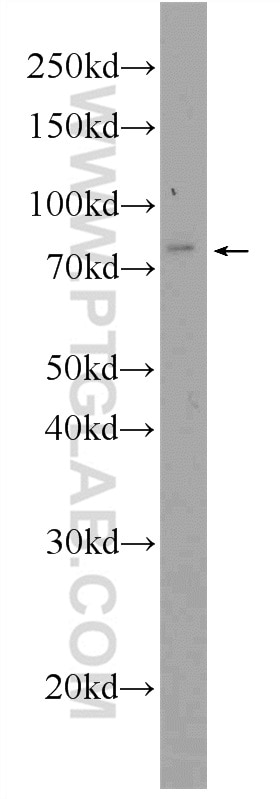 Western Blot (WB) analysis of rat brain tissue using PROX1 Polyclonal antibody (51043-1-AP)