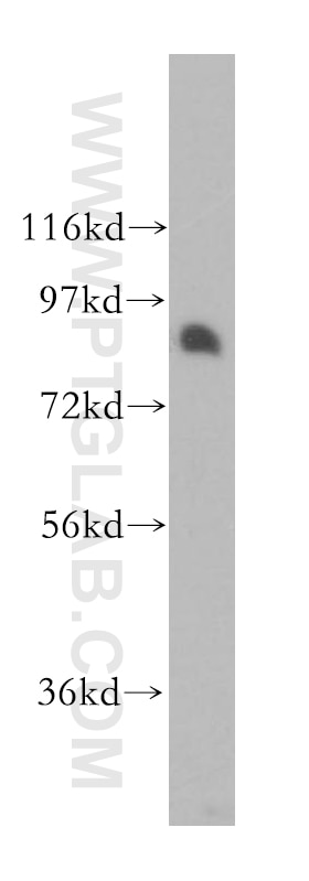 Western Blot (WB) analysis of human brain tissue using PROX1 Polyclonal antibody (51043-1-AP)